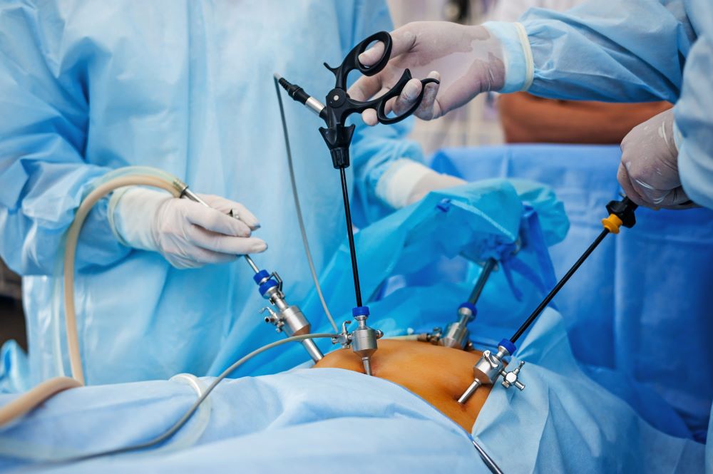 Laparoscopic hysterectomy services in Kenya Laparoscopic hysterectomy is a surgical procedure where the uterus is removed using small incisions in the abdomen. It's a minimally invasive approach compared to traditional open surgery, offering benefits like shorter recovery times, reduced pain, and lower risk of infection. This procedure is often chosen for conditions such as uterine fibroids, endometriosis, or certain cancers. Our laparoscopic hysterectomy service redefines the experience of undergoing a hysterectomy. Say goodbye to the traditional approach and embrace a minimally invasive solution that ensures faster recovery, reduced scarring, and enhanced precision. Contact us and let the serenity of expert care take possession of your well-being. Your path to a fulfilling and healthy life begins with us. Reach out today and experience the difference. We are located at Thika town, Kwame Nkurumah Rd, Pushpa Plaza, (Opp Unaitas bank) 4th floor Suite E2. Contact us on (+254) 0796 633428 Email: info@saumed.co.ke