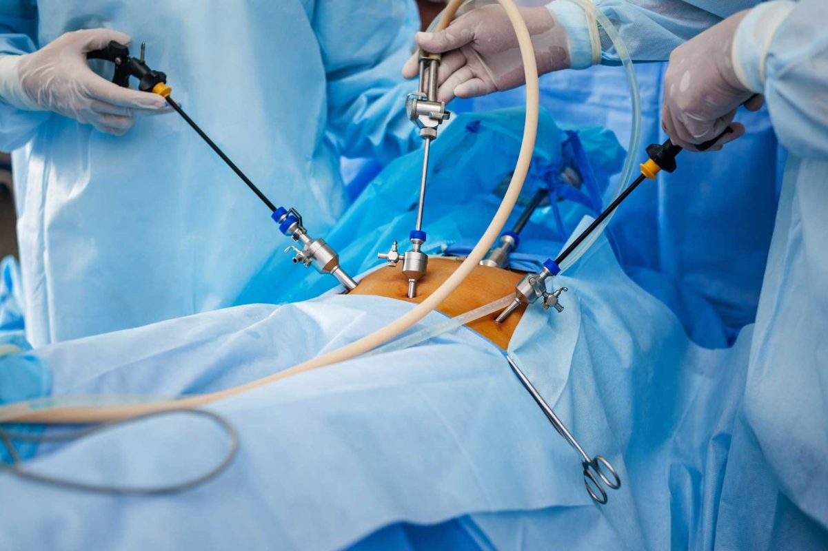Minimally invasive surgical procedures performed through small incisions in the abdomen using a camera (laparoscope) and specialized surgical instruments.